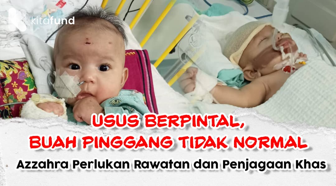 URGENT! Nyawa Baby Azzahra Husna Dalam Bahaya Tanpa Rawatan Segera!