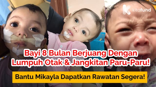 Dana Kasih Baby Nur Mikayla Masih Perlukan Bantuan Anda