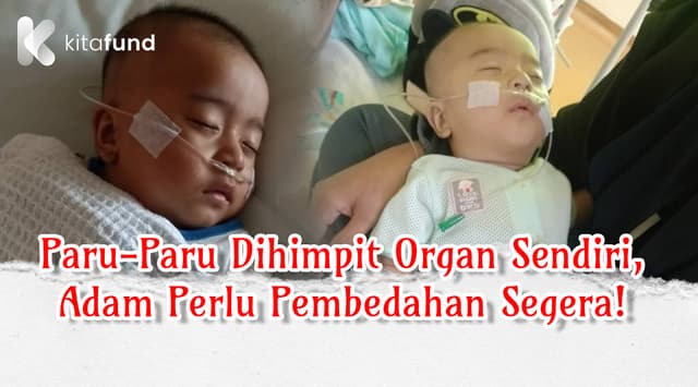 Usus & Buah Pinggang Menghimpit Paru-paru, Baby Adam Perlukan Pembedahan Segera!